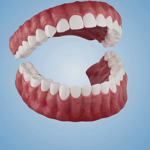 SmileFitPro™ – Lösung der neuen Generation: Flexible Vollprothese